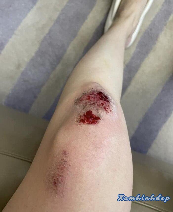 ảnh ngã xe 3d full