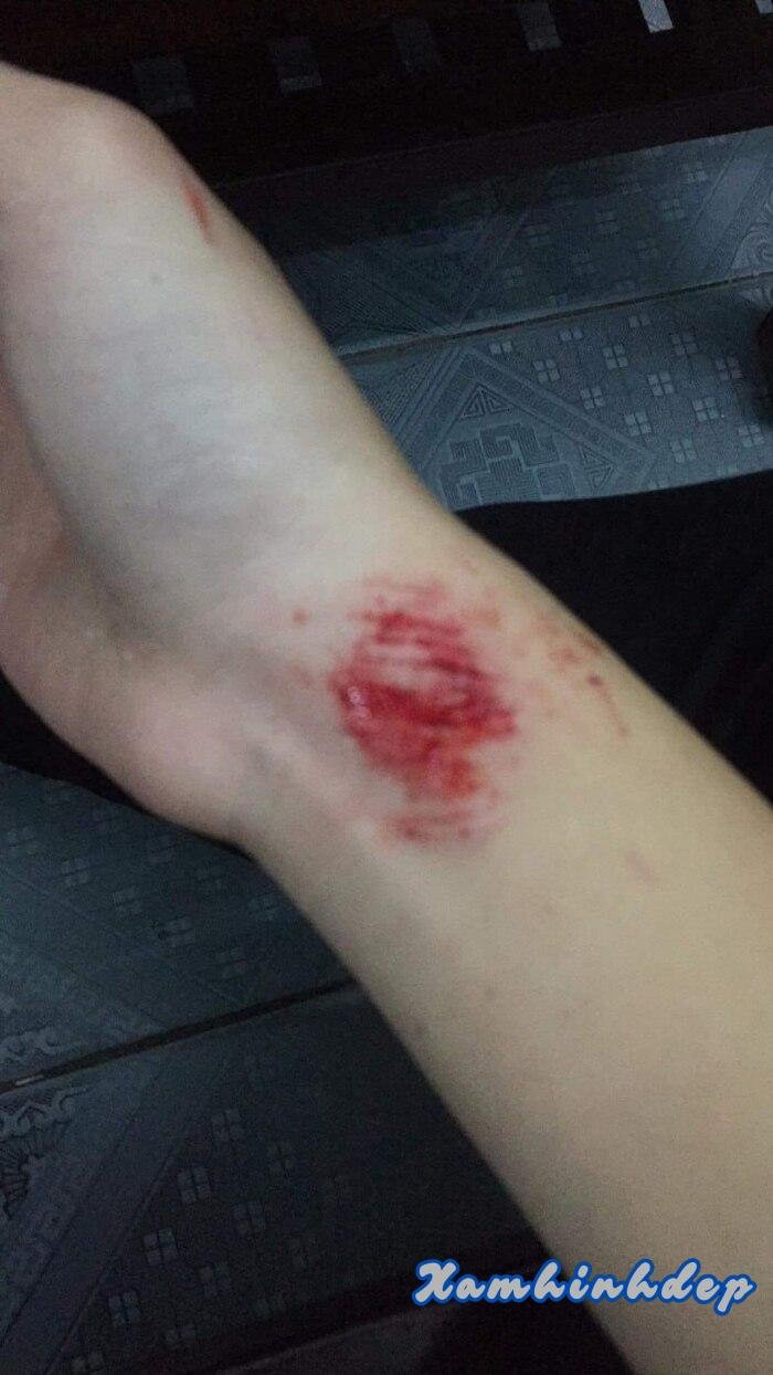 ảnh ngã xe 3s full