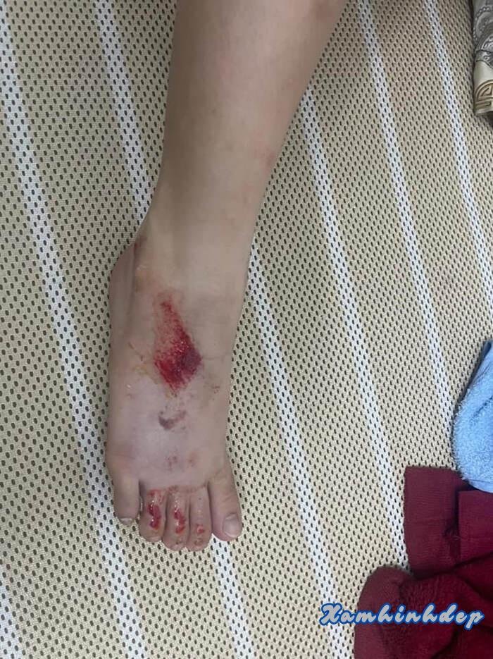 ảnh ngã xe 5d full