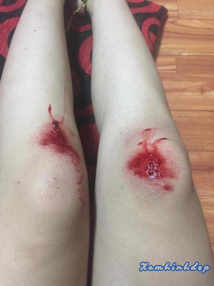 ảnh ngã xe 5k full