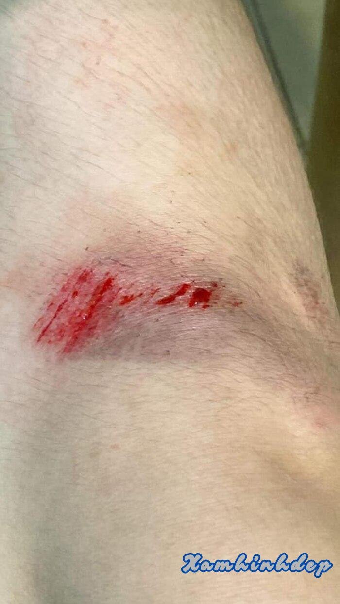 ảnh ngã xe đau 3k