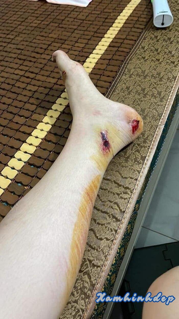 ảnh ngã xe đau 4k