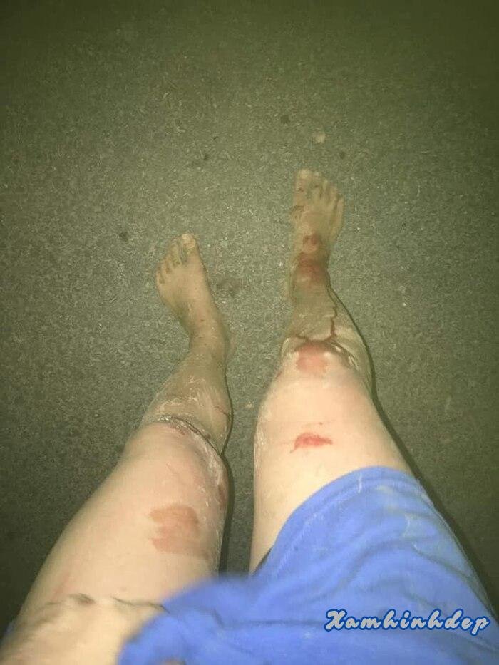 ảnh ngã xe full hd