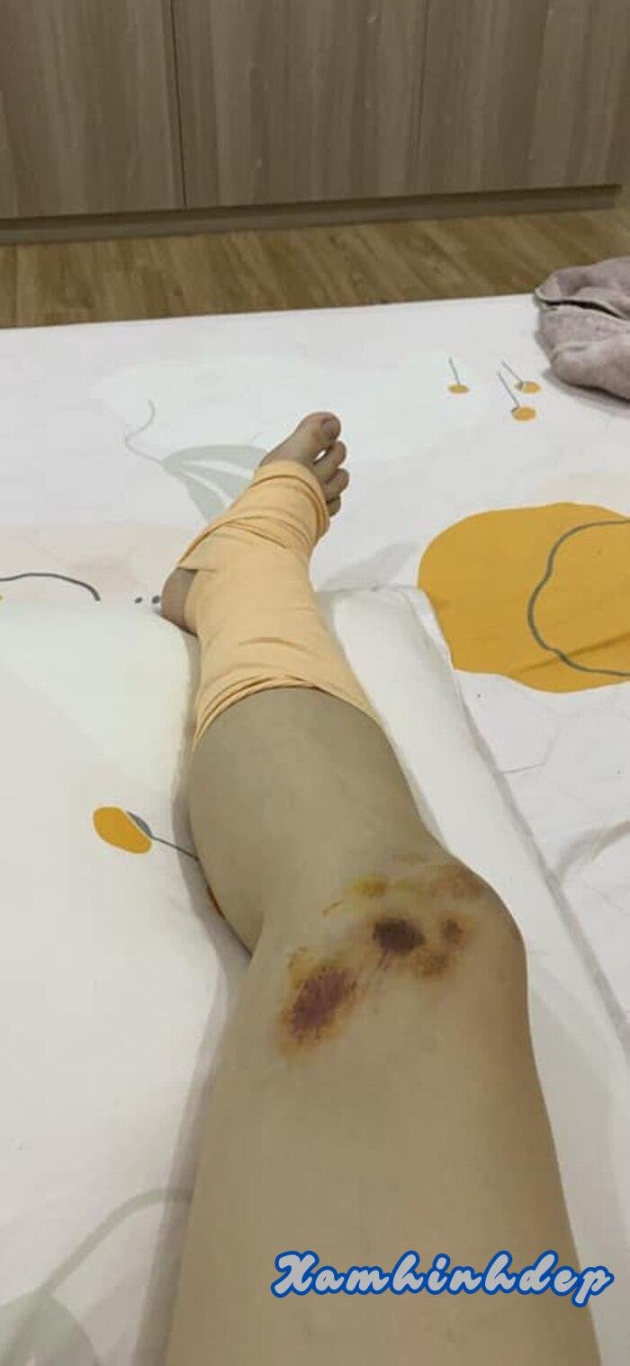 ảnh ngã xe hd full